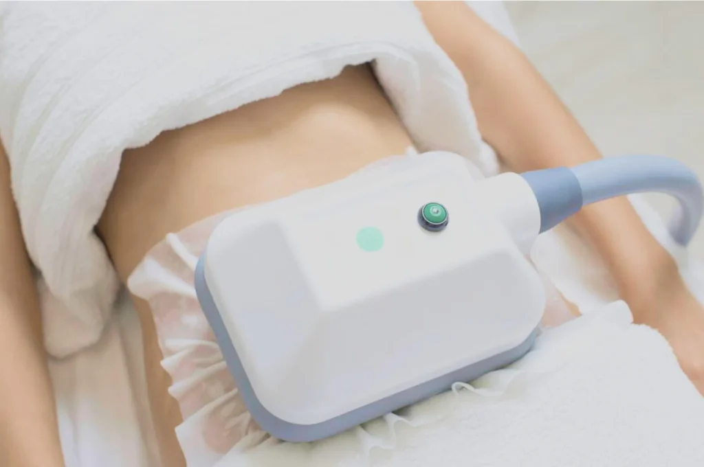 How Fat Freezing and HIFU Work Together? 3 advantages to combining Fat Freezing and HIFU Buckingham
