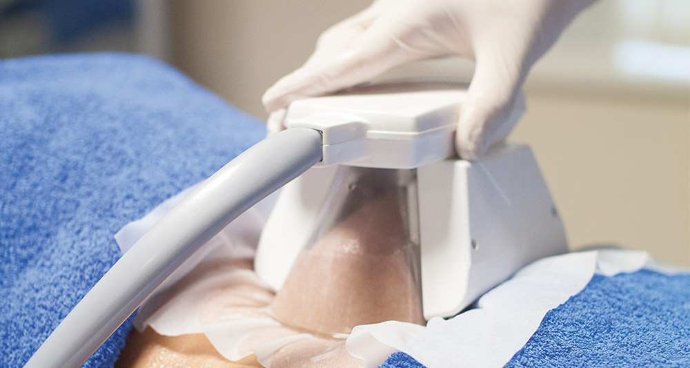 How Fat Freezing and HIFU Work Together? 2 Multiple Areas in One Session HIFU and Fat Freezing Buckingham