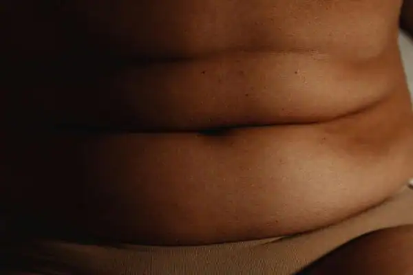 The Hidden Connection: How Stress Shapes Your Fitness and Body Composition 3 image of what stress can do on the stomach area and how Lipo 360 Buckingham can help to change your body shape.